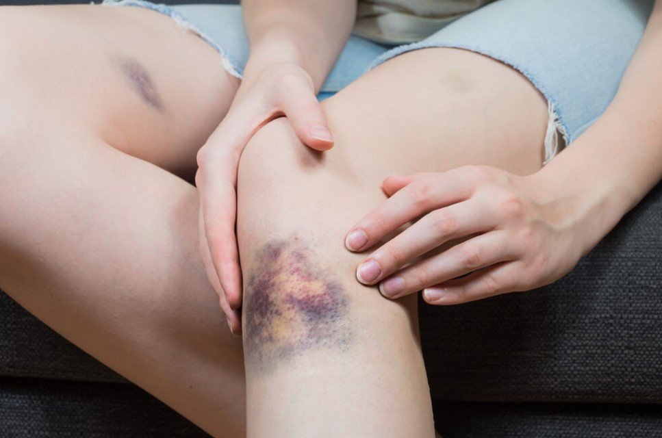 Chequeo de Coagulación