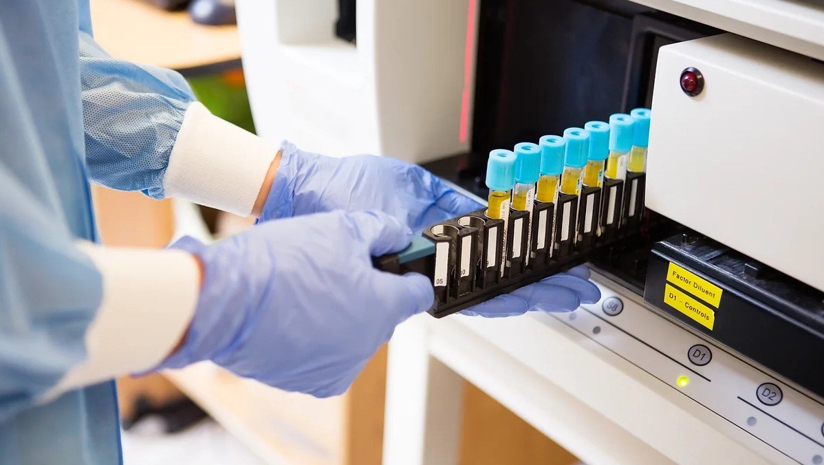 Chequeo de Coagulación - Image 3