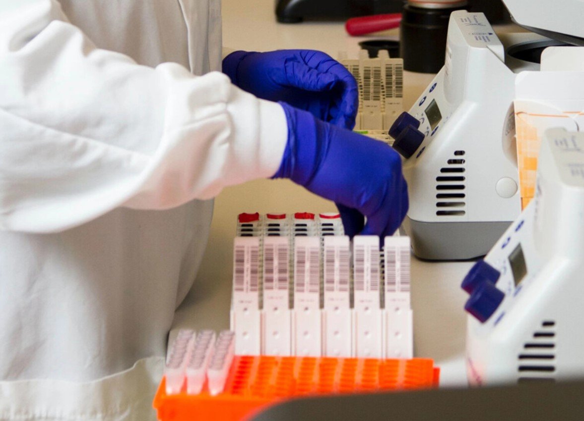 Chequeo de Coagulación - Image 2